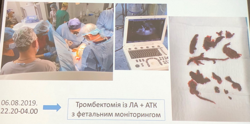 У Вінниці провели операцію на відкритому серці вагітній жінці