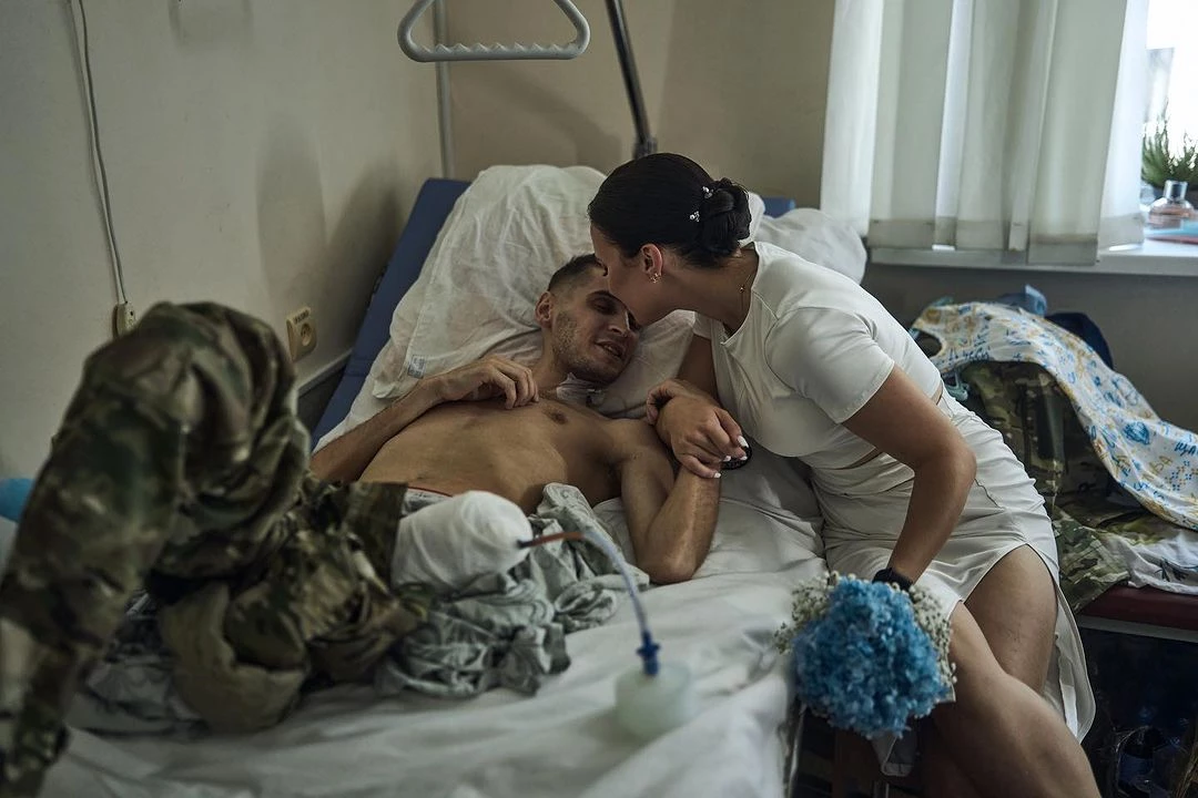 Лікарі казали, що не виживе. Історія кохання Анни і Влада, що одружилися у шпиталі