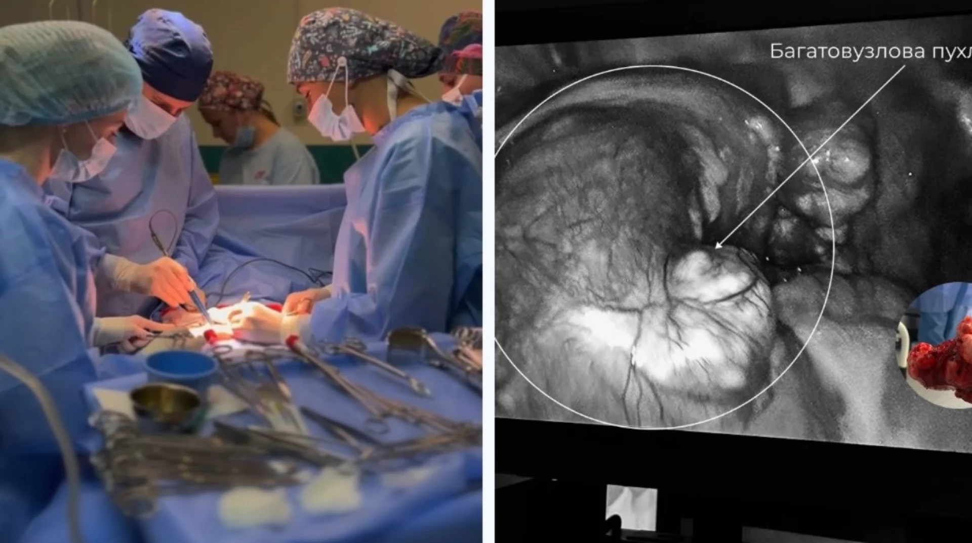 У Львові провели унікальну операцію жінці, які народилася без матки