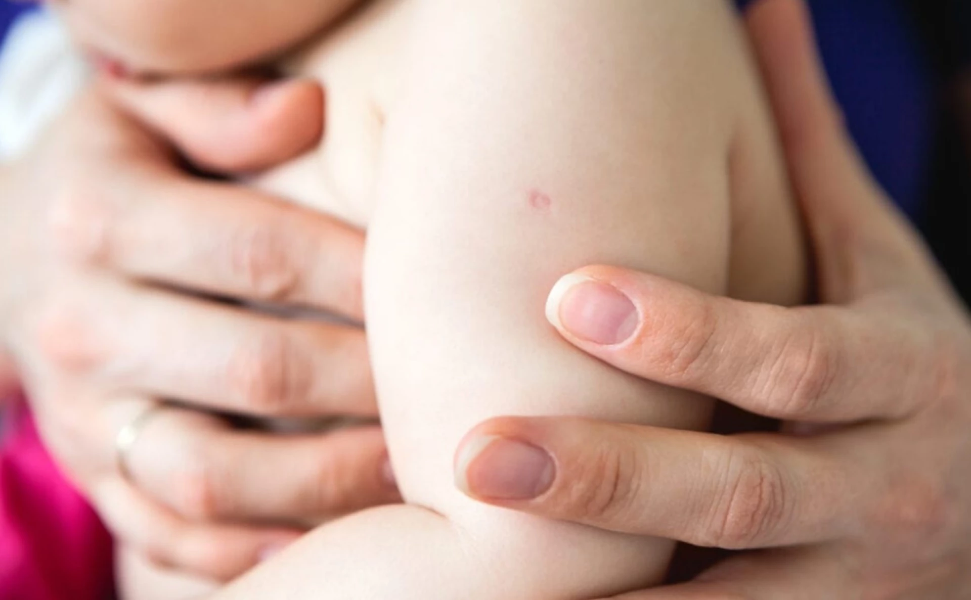 Вакцинацію БЦЖ робитимуть дітям у пологовому раніше. Змінили терміни