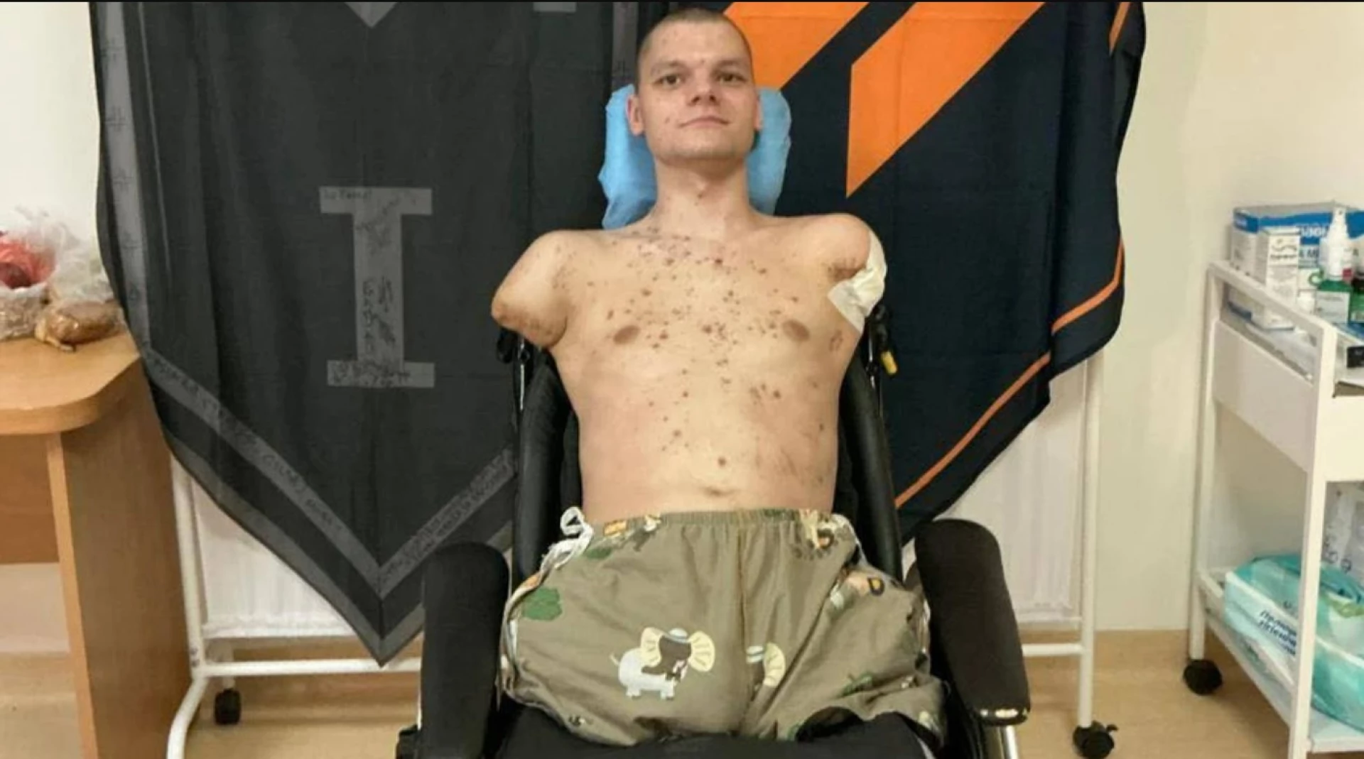 Тримайте в руках: в «ПриватБанку» не видали картку ветерану з ампутацією всіх кінцівок