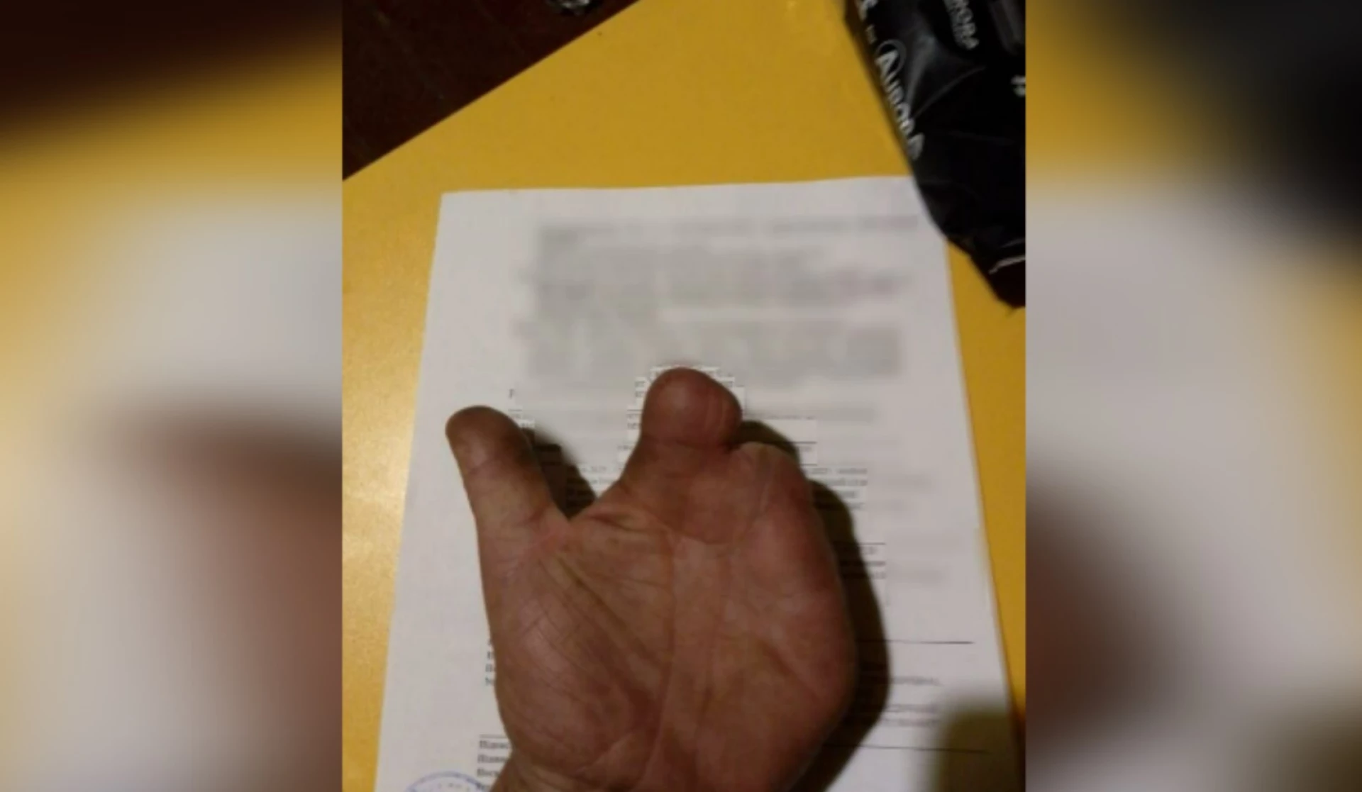 Військового без пальців відправили кріпити антидронові сітки, – Шабунін