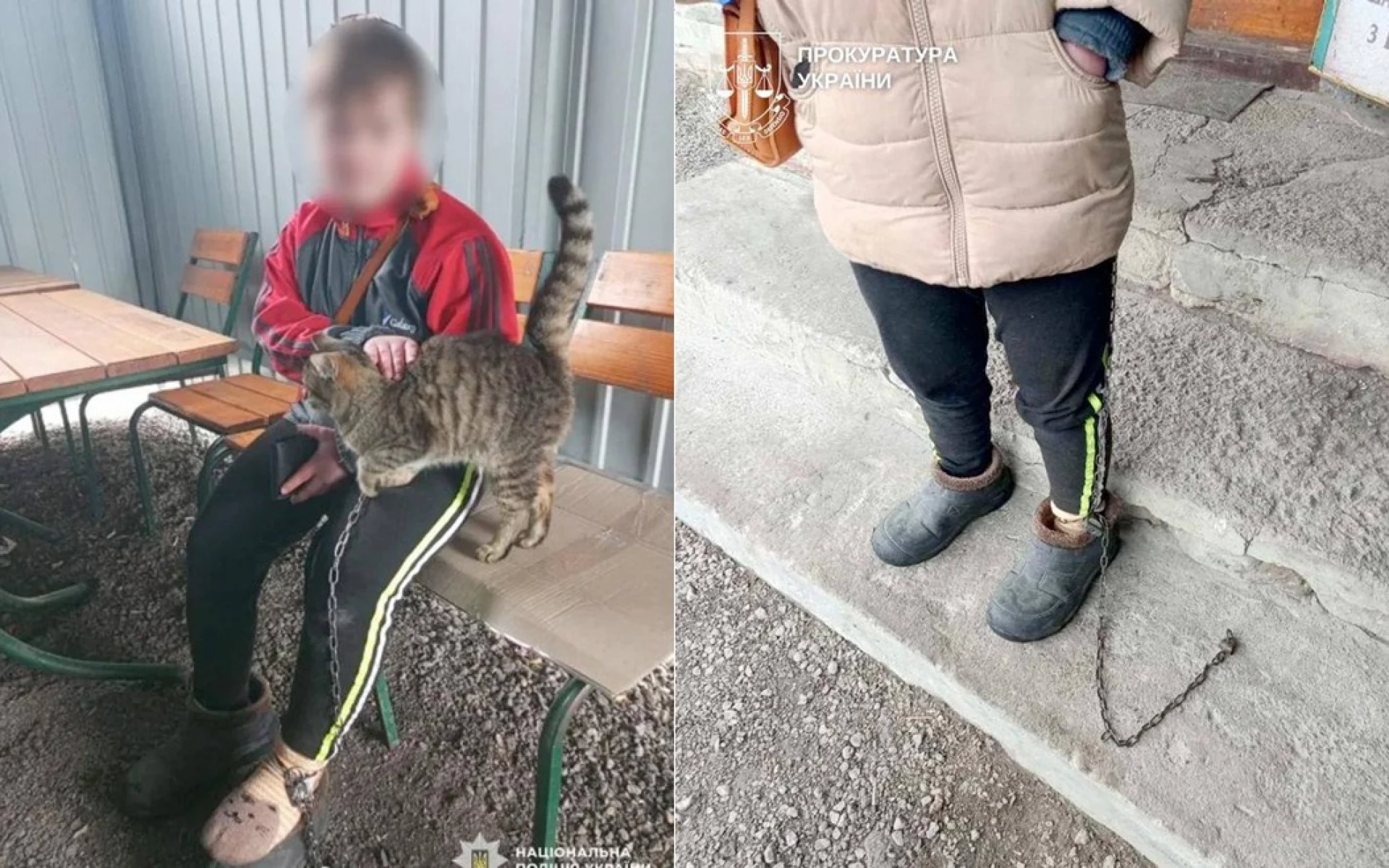 На Кіровоградщині жінка тримала на ланцюгах дівчину із синдромом Дауна