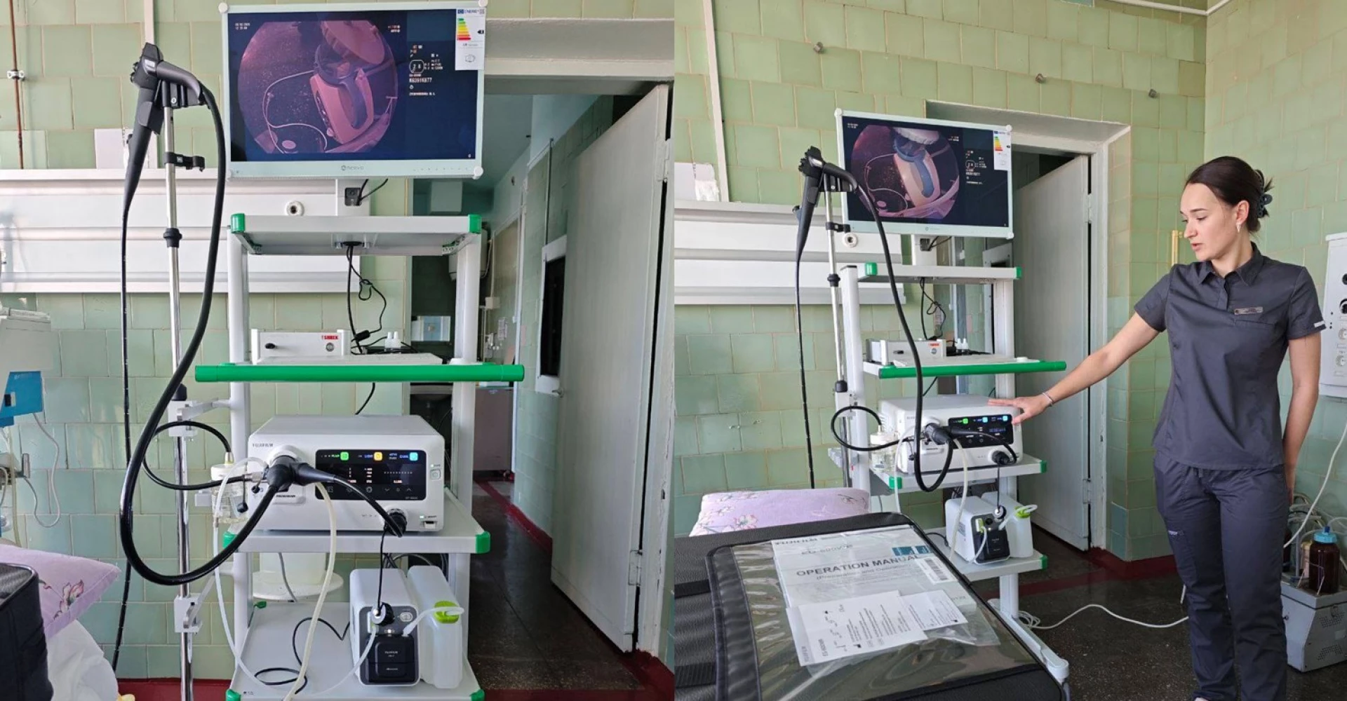 Лікарня у Звенигородці купила в лізинг обладнання для ендоскопії та колоноскопії