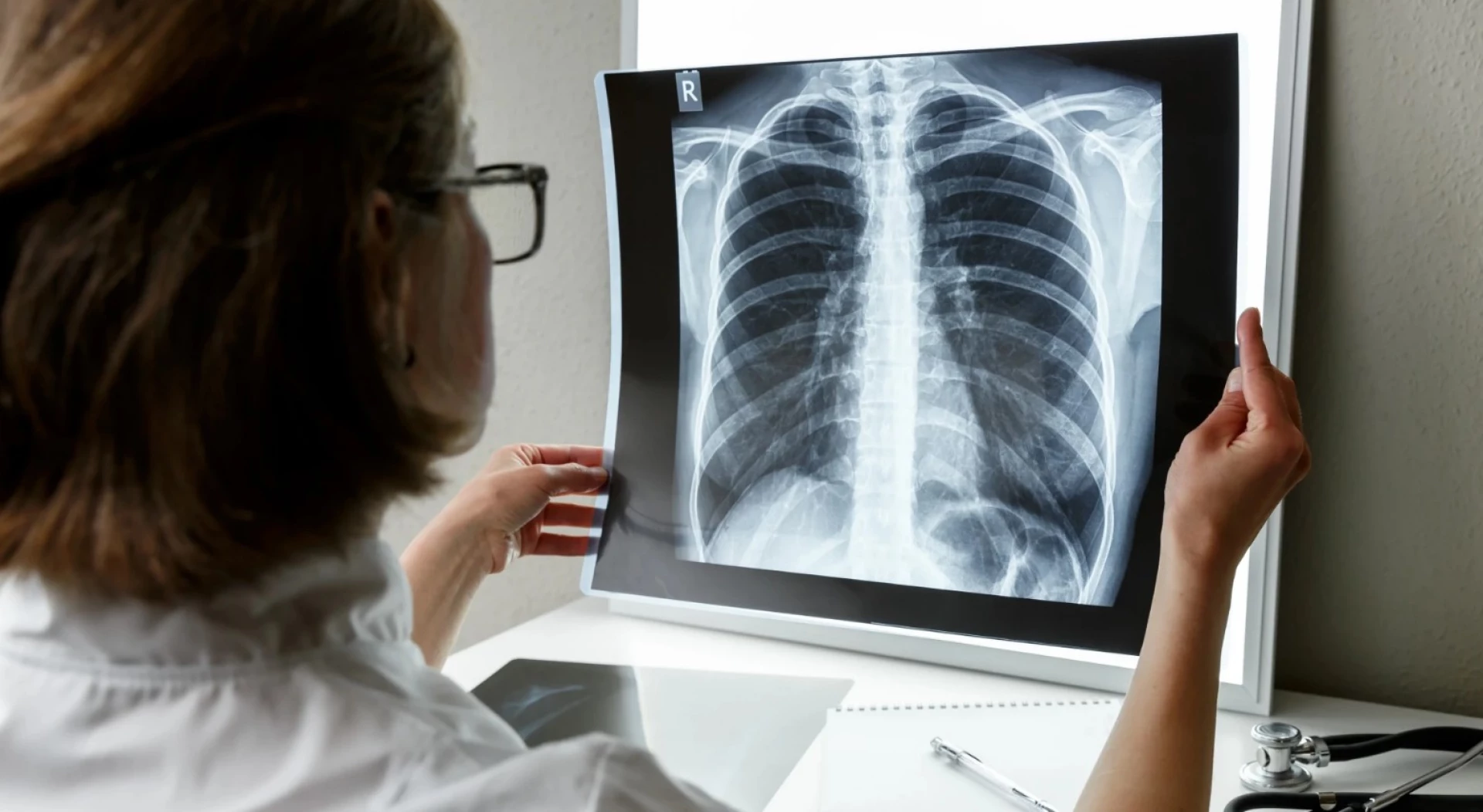 У Каневі зростає кількість випадків пневмонії