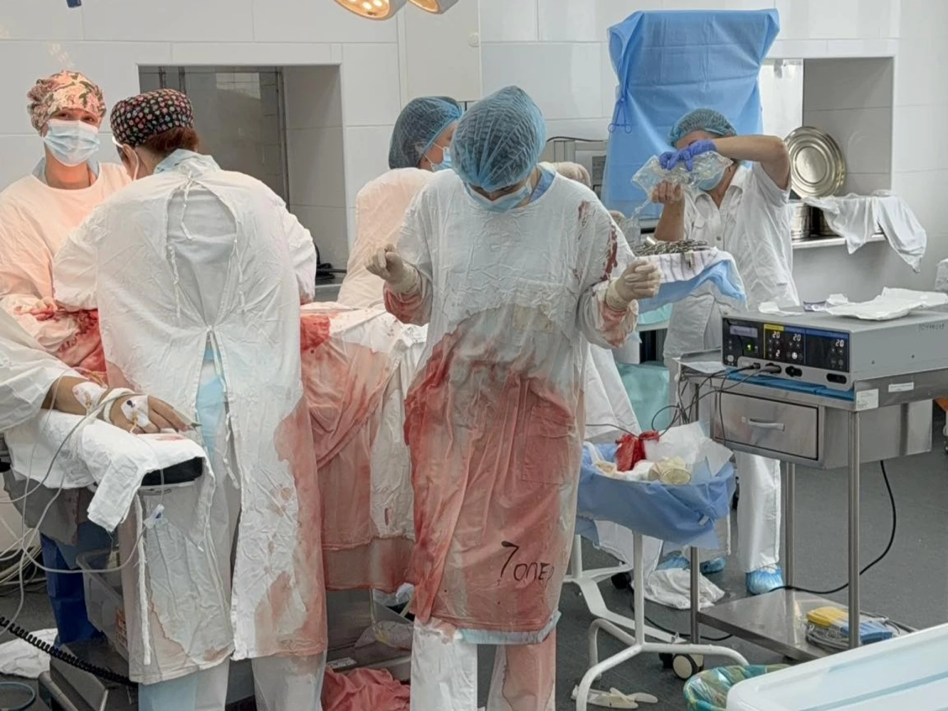 Київські лікарі врятували дитину з важким ураженням кишківника