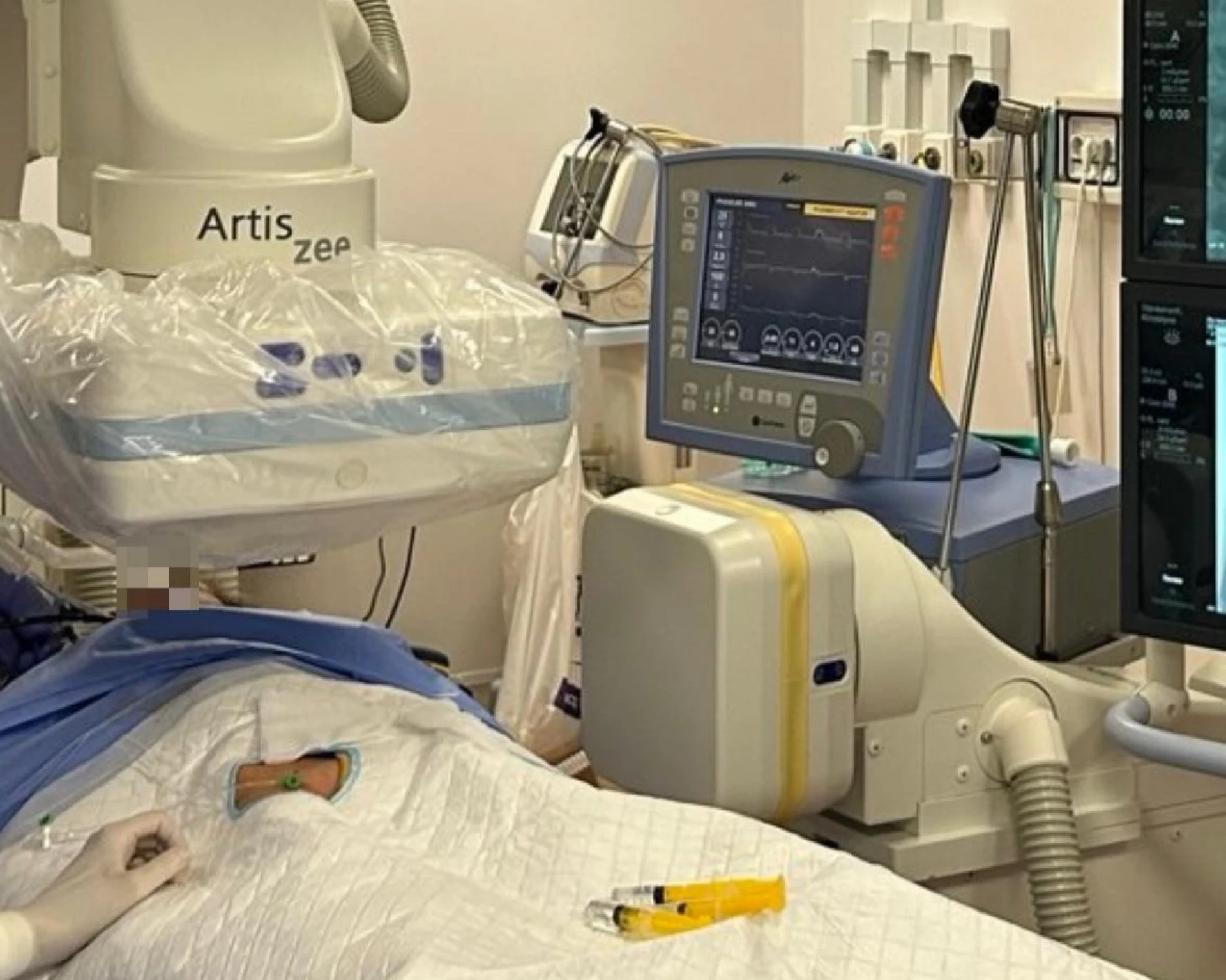 Київські лікарі врятували жінку від ампутації, відновивши кровотік у нозі