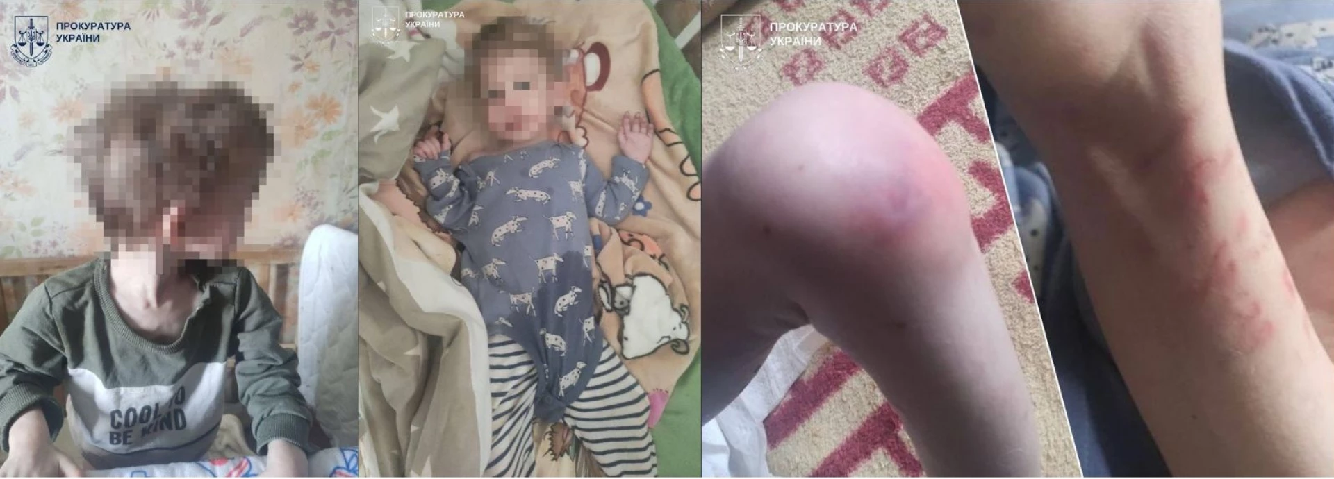 Відсутність світла і газу, таргани, недоїдання та синці: у Білій Церкві троє дітей жили без належного догляду