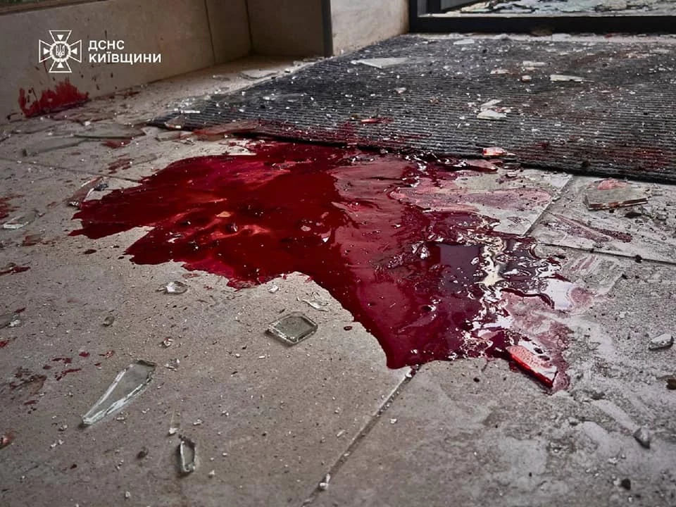 Внаслідок російської атаки на Київщину постраждала трирічна дитина