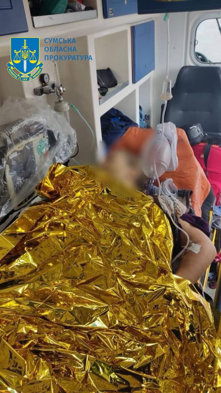 У кареті швидко допомоги померла жителька Сумщини, яка отримала поранення через обстріл