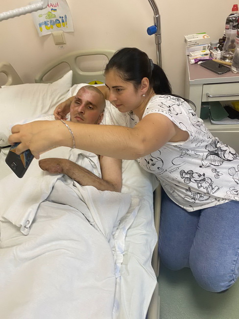 Дві зупинки серця та понад 30 операцій: історія молодого танкіста, якого врятували вінницькі лікарі