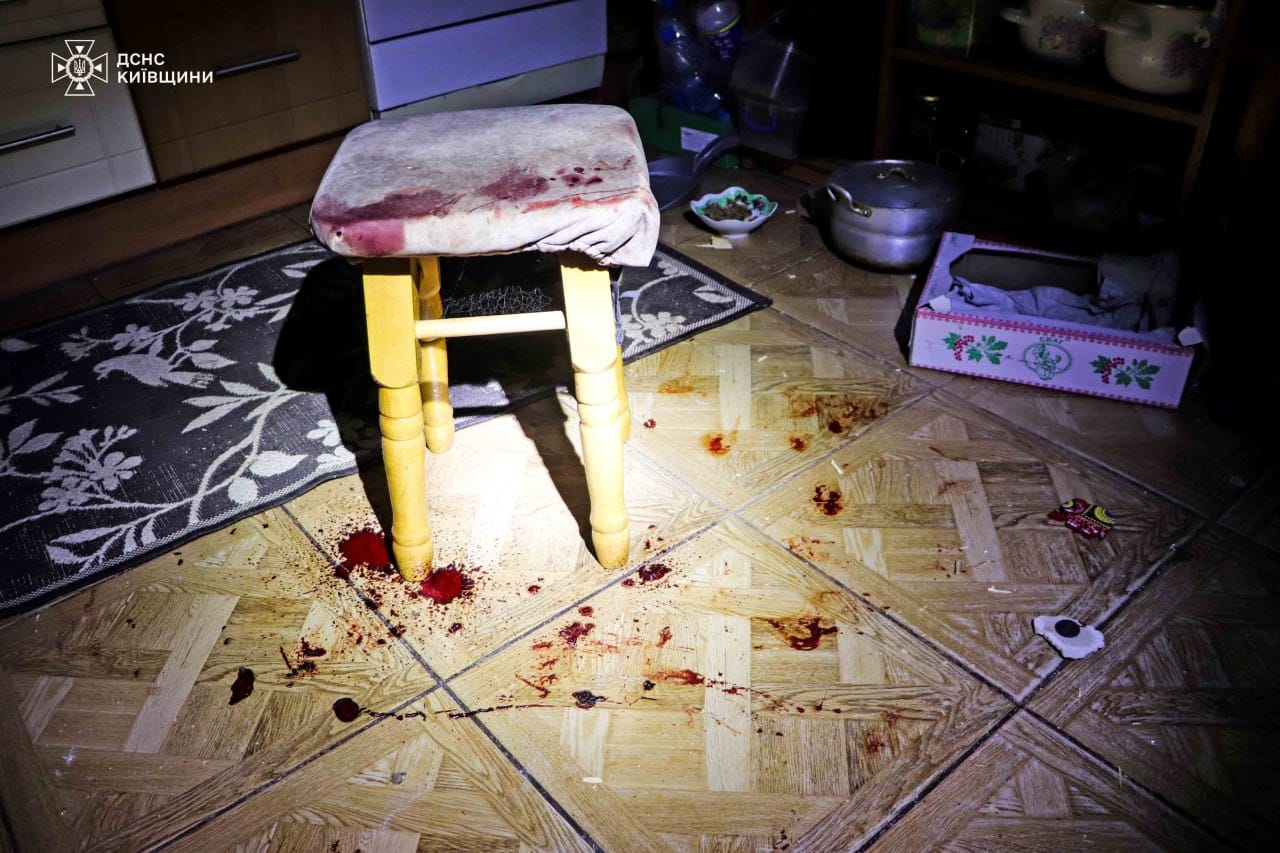 На Київщині внаслідок ворожого обстрілу дитина отримала поранення та контузію