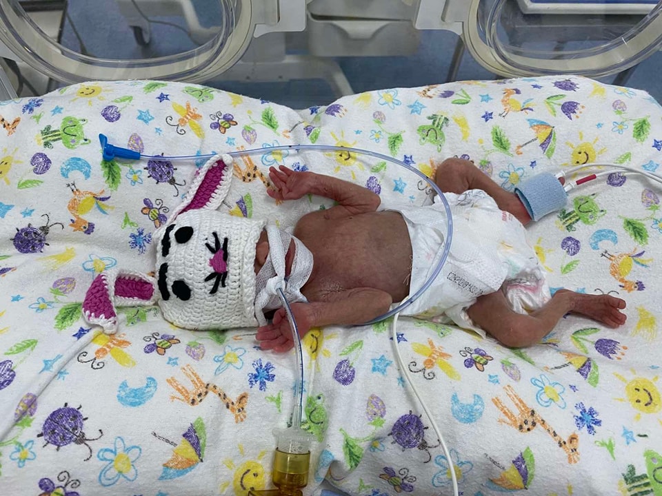 У Черкасах виходили новонароджену дівчинку вагою 650 грамів