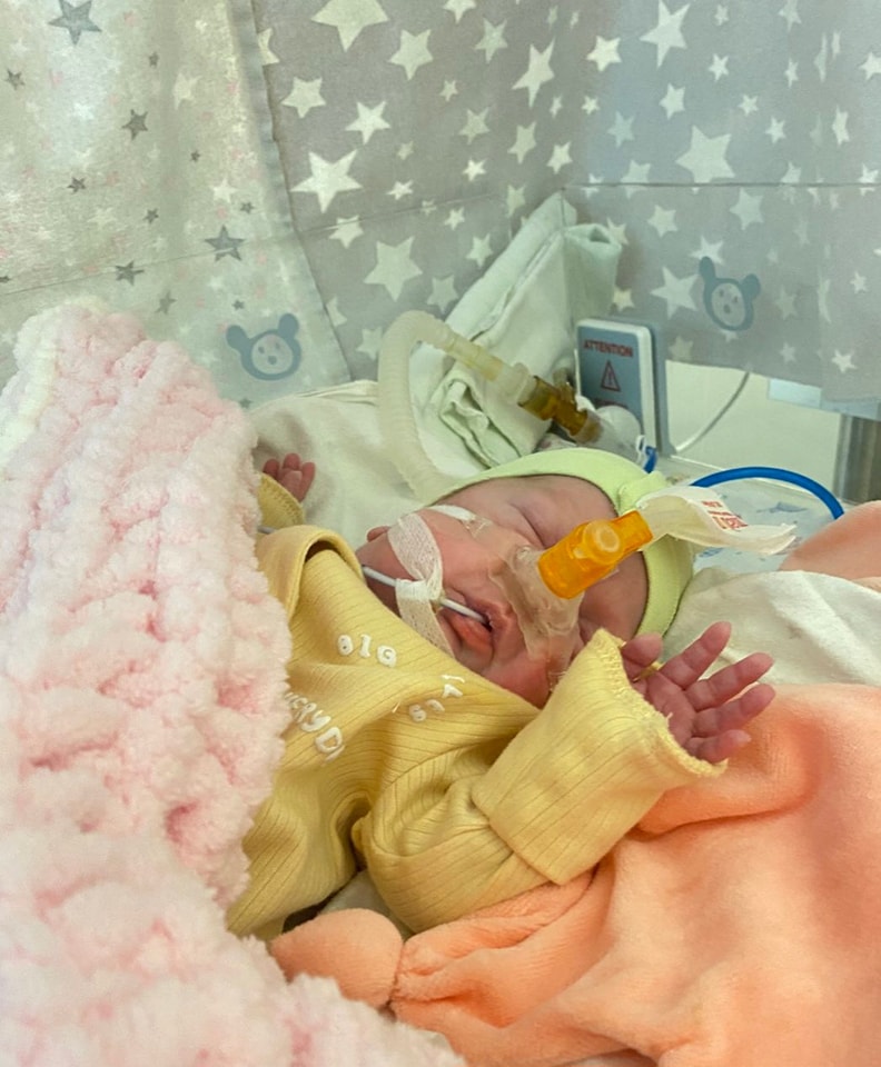 У Черкасах виходили новонароджену дівчинку вагою 650 грамів - фото 2