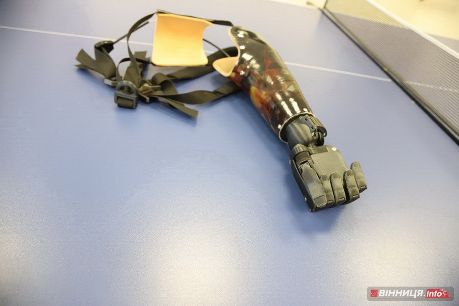 «Черг не має»: як у Вінниці можна доступно і безоплатно отримати протезування - фото 2