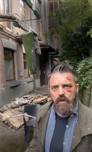 У Києві на громадянина США впав балкон