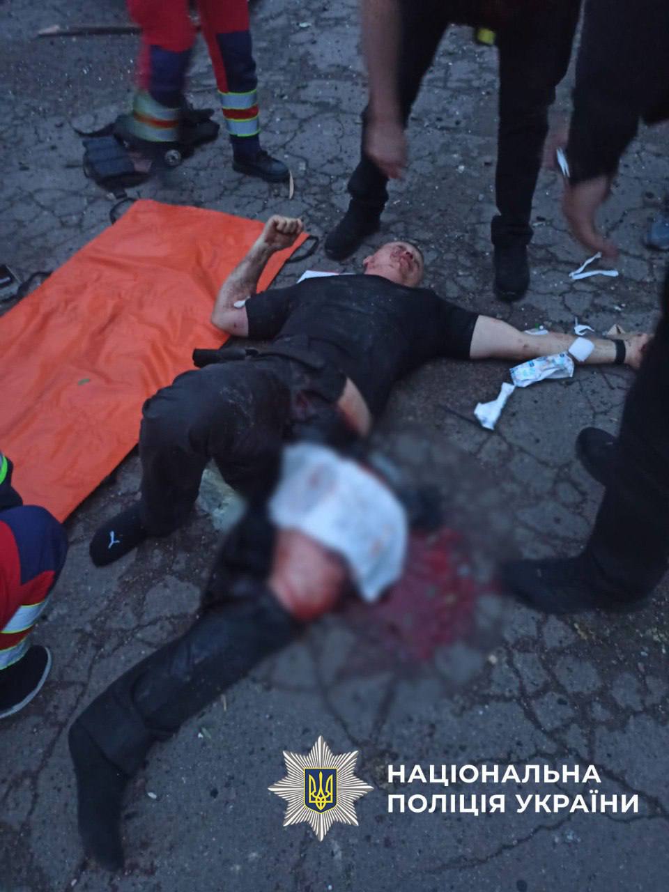 Троє поліцейських, які постраждали під час ракетного удару рф по Києву, досі у лікарні