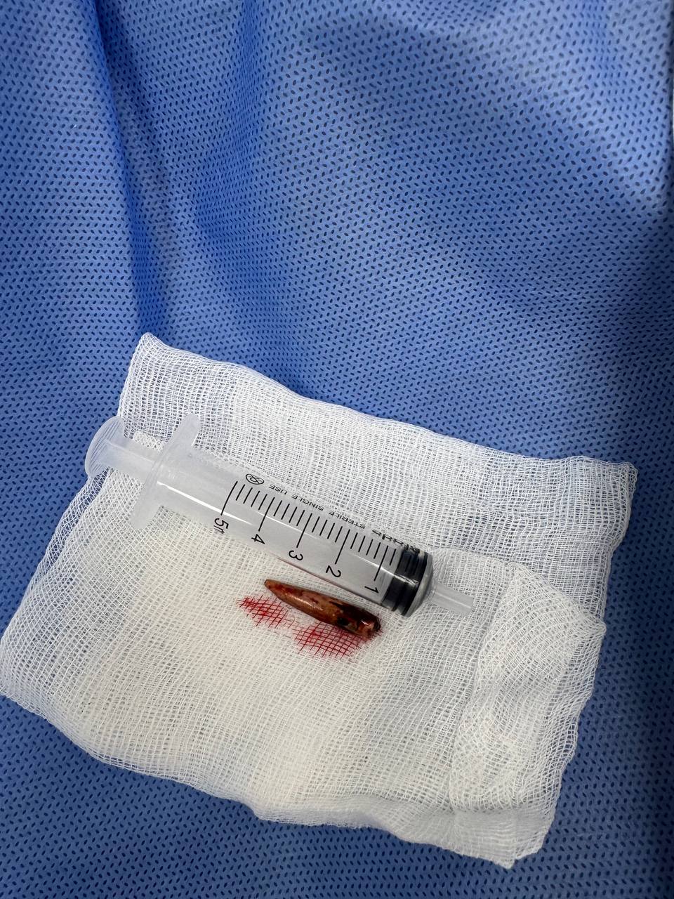 Київські медики дістали кулю з шиї військового