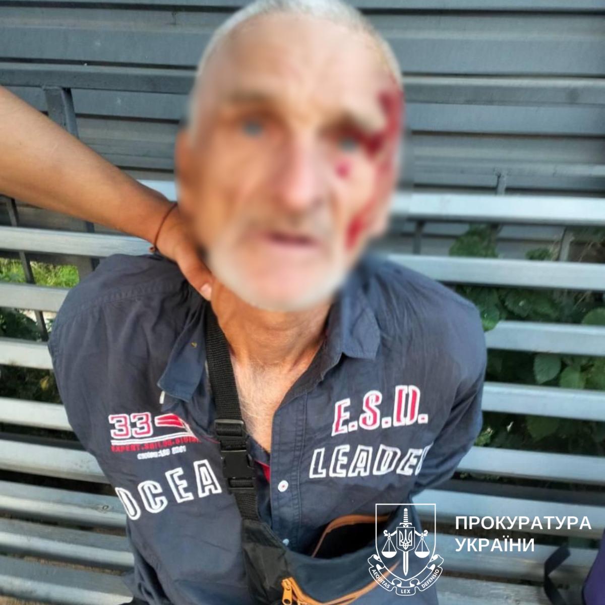 У Києві затримали 60-річного ґвалтівника, який нападав на жінок у столиці