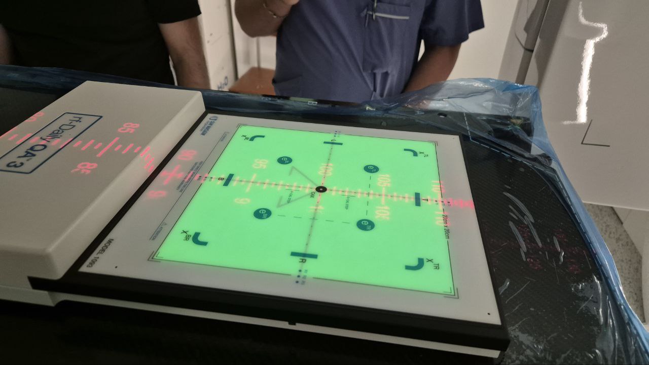 У Черкаському онкоцентрі розповіли, як працює новий лінійний прискорювач