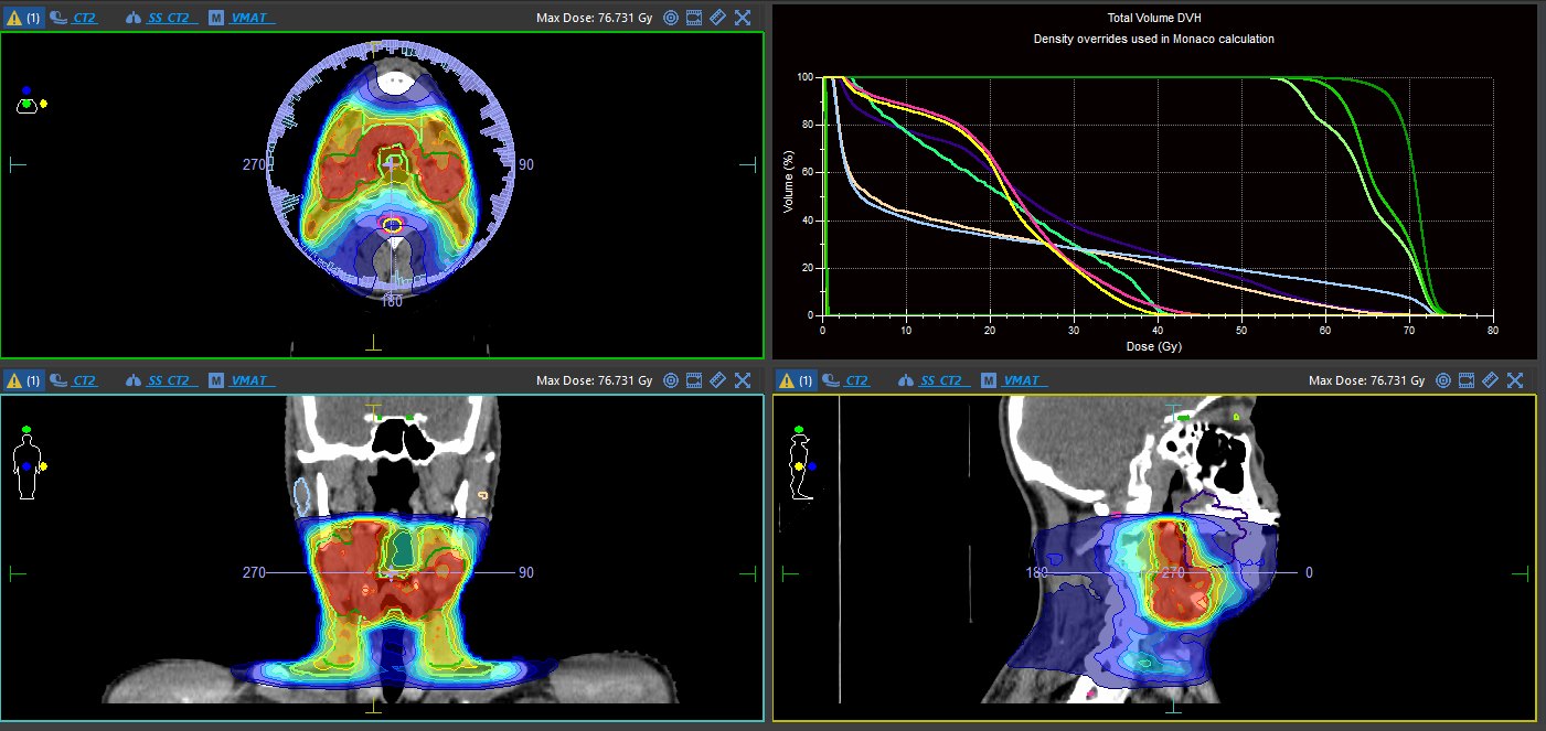 У Черкаському онкоцентрі розповіли, як працює новий лінійний прискорювач - фото 2