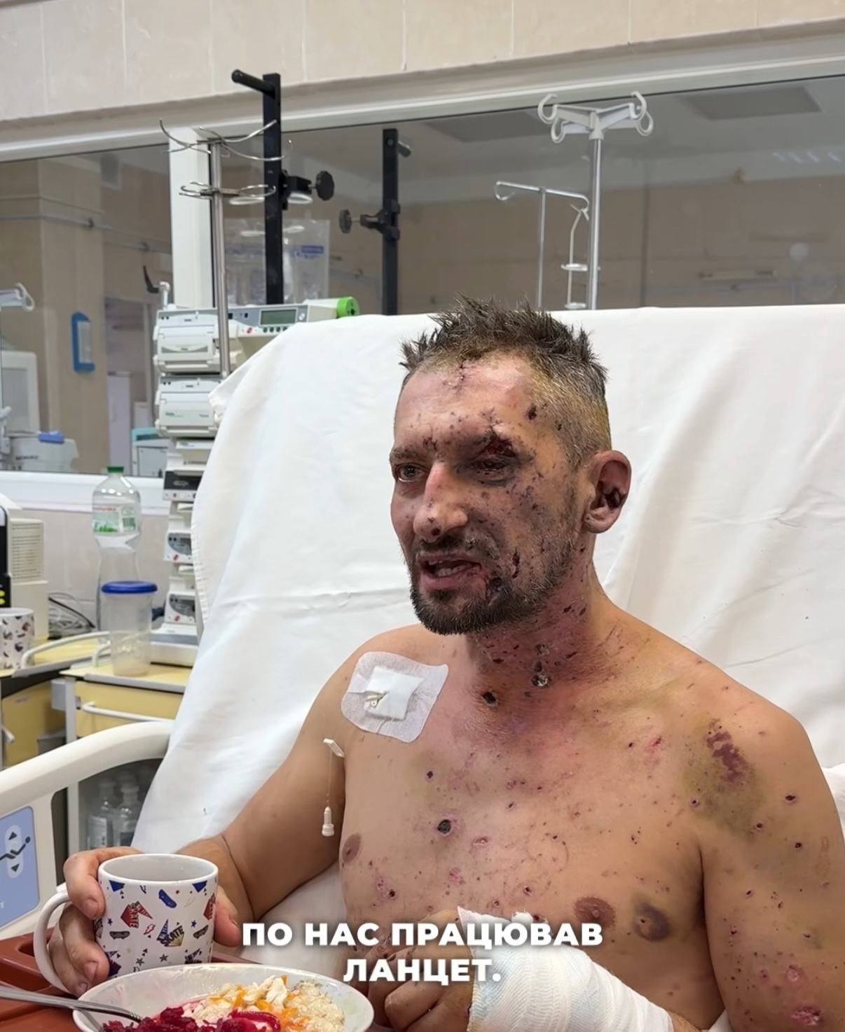 У Дніпрі рятують пораненого під Краматорськом журналіста, який єдиний вижив після удару FPV-дроном