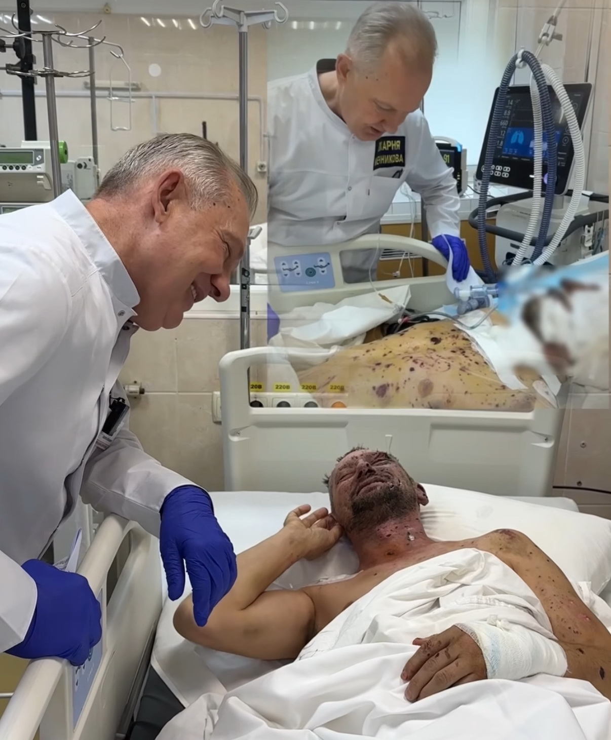 У Дніпрі рятують пораненого під Краматорськом журналіста, який єдиний вижив після удару FPV-дроном - фото 2