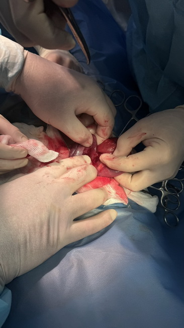 Дванадцять магнітів дістали з дитини вінницькі лікарі - фото 3