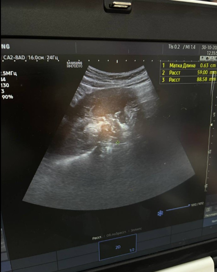 Народила дитину кілька місяців тому: вінницькі хірурги врятували дівчину з кровотечю