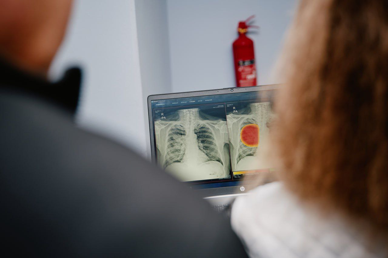 У протитуберкульозному диспансері на Черкащині встановили нове обладнання - фото 3