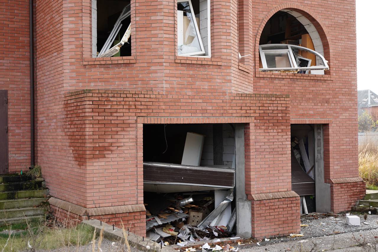 Уламкові поранення та опіки: в якому стані зараз постраждалі на Київщині