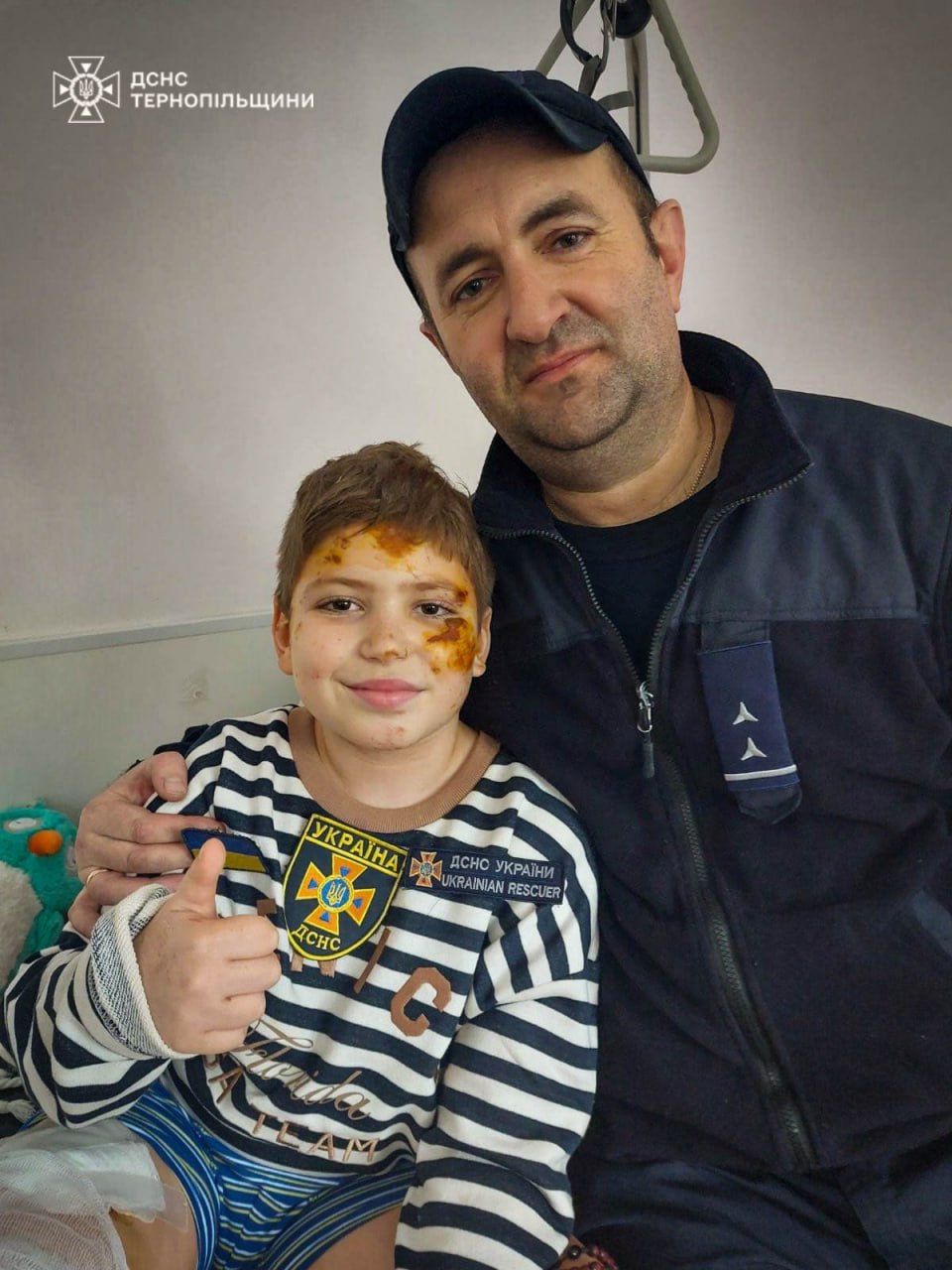 Історія порятунку 10-річного Максима після ракетного удару в Тернополі - фото 2