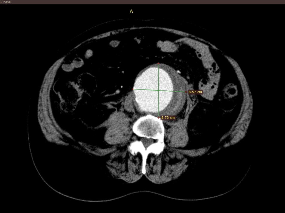 Київські лікарі успішно прооперували мешканця Кіровоградщини