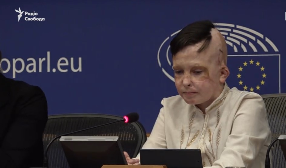 Перекладачка розплакалася від історії хлопчика, що вижив після удару по Вінниці - фото 2