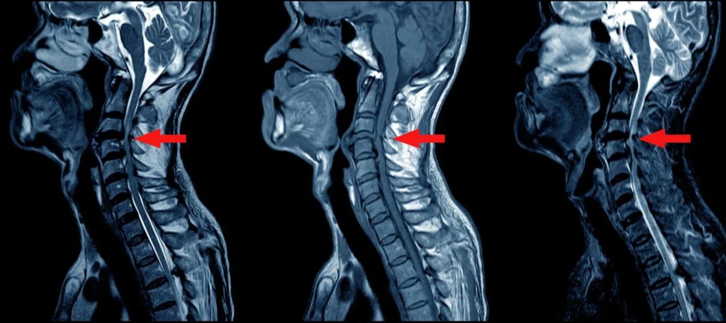 Де зробити МРТ в Києві безкоштовно: поради та перелік лікарень