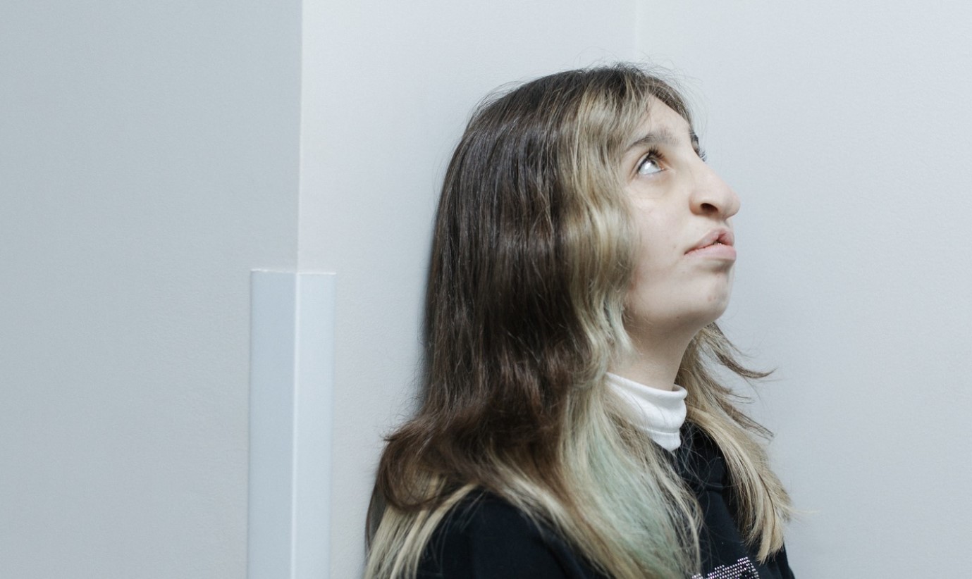 У Львові дівчині сформували ніс, взявши частини з ребра і вуха - фото 2