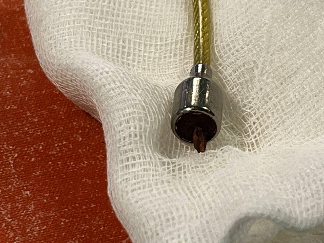 Київські лікарі врятували життя бійця з множинними осколковими пораненнями кінцівок і шиї