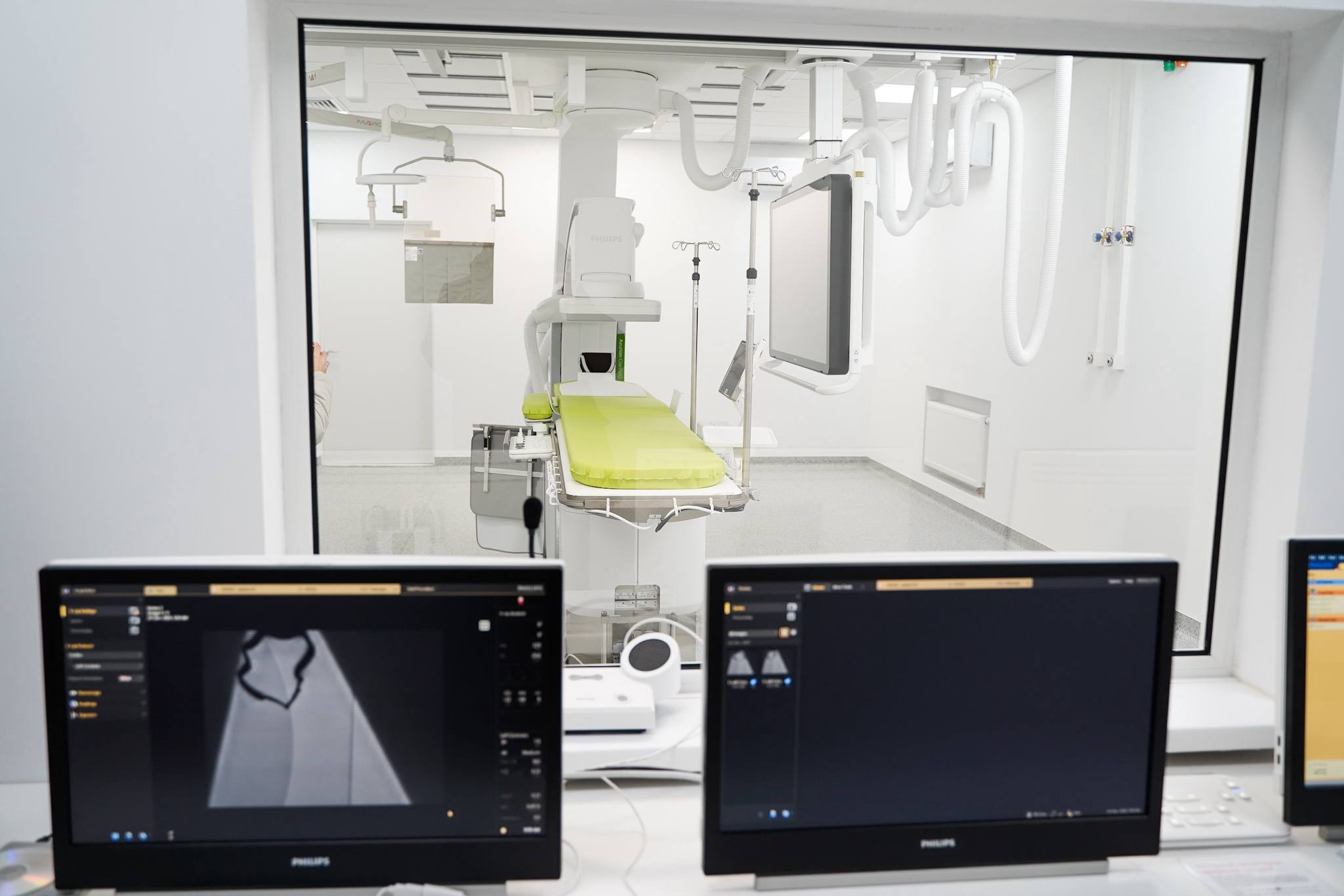 В обласній лікарні на Київщині запрацювала нова система МРТ - фото 2