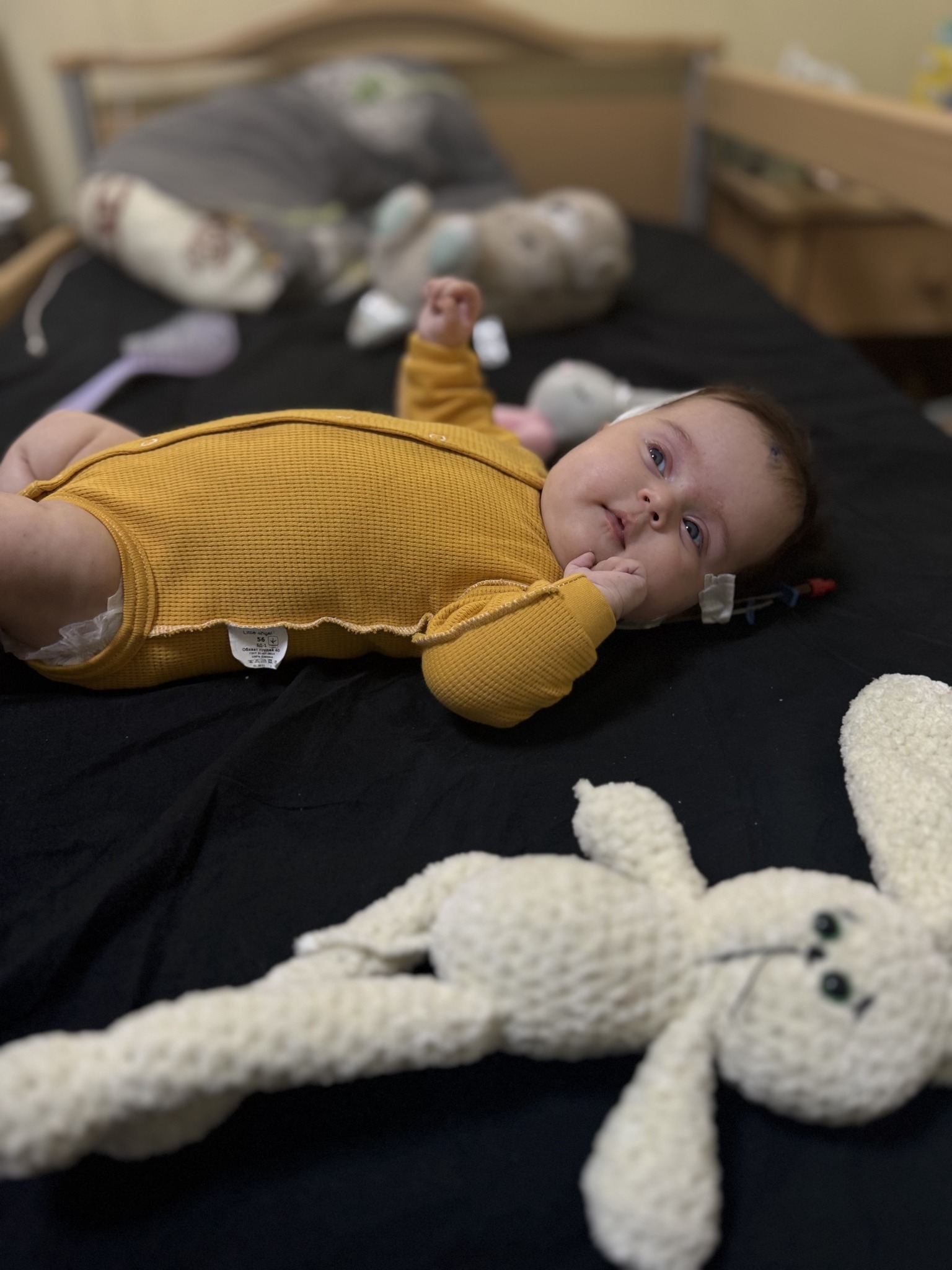 Небезпечну пухлину видалили з мозку 2-місячної Олівії з Рівного - фото 2