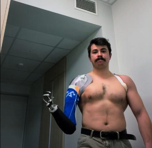 Український захисник Ярослав Грубич показав, як вчиться керувати своїм першим механічним протезом