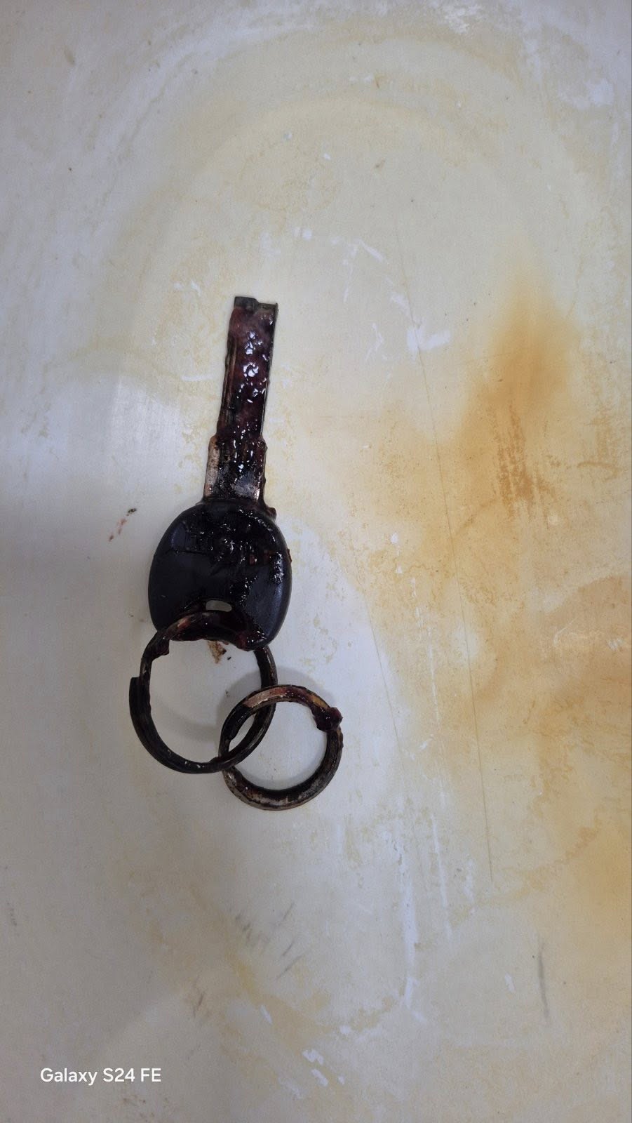 На Тернопільщині лікарі дістали ключа зі стравоходу жінки - фото 2