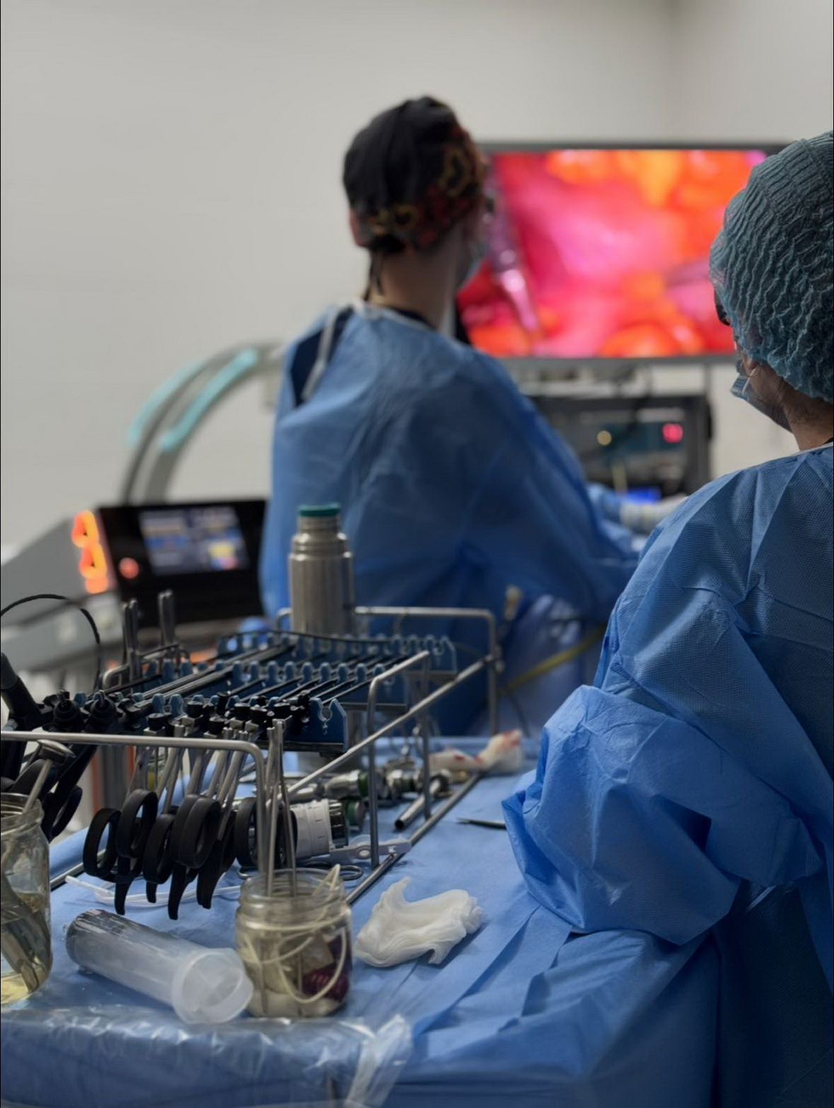 У Вінниці лікарі сформували новий орган замість ураженого пухлиною: успішна операція в лікарні ім. Пирогова - фото 2