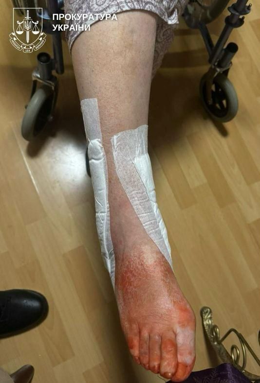 Переломи, розтрощені авто та витрати на лікування – прокурори повідомили про підозру посадовцям комунальних підприємств Києва - фото 7