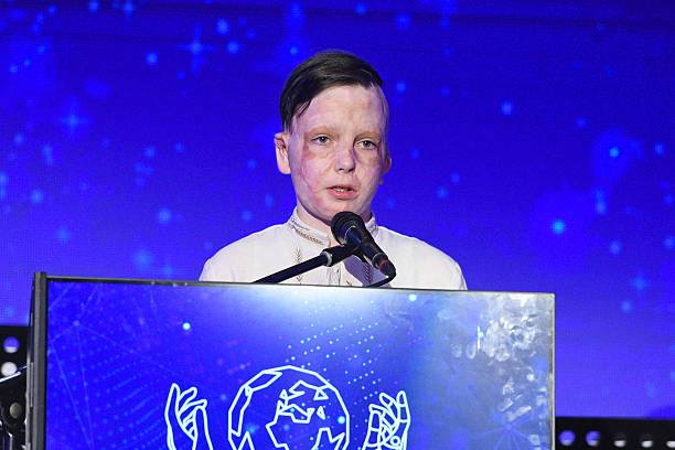 Хлопчик, що вижив після удару рф по Вінниці, отримав міжнародну відзнаку на Berlinale - фото 2