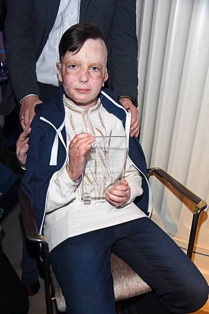 Хлопчик, що вижив після удару рф по Вінниці, отримав міжнародну відзнаку на Berlinale - фото 5