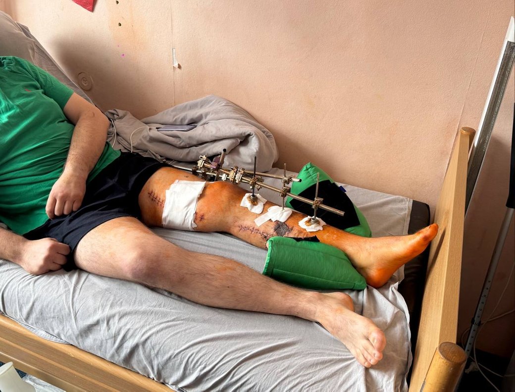 Поранений під час стрілянини на Черкащині поліцейський розповів деталі подій