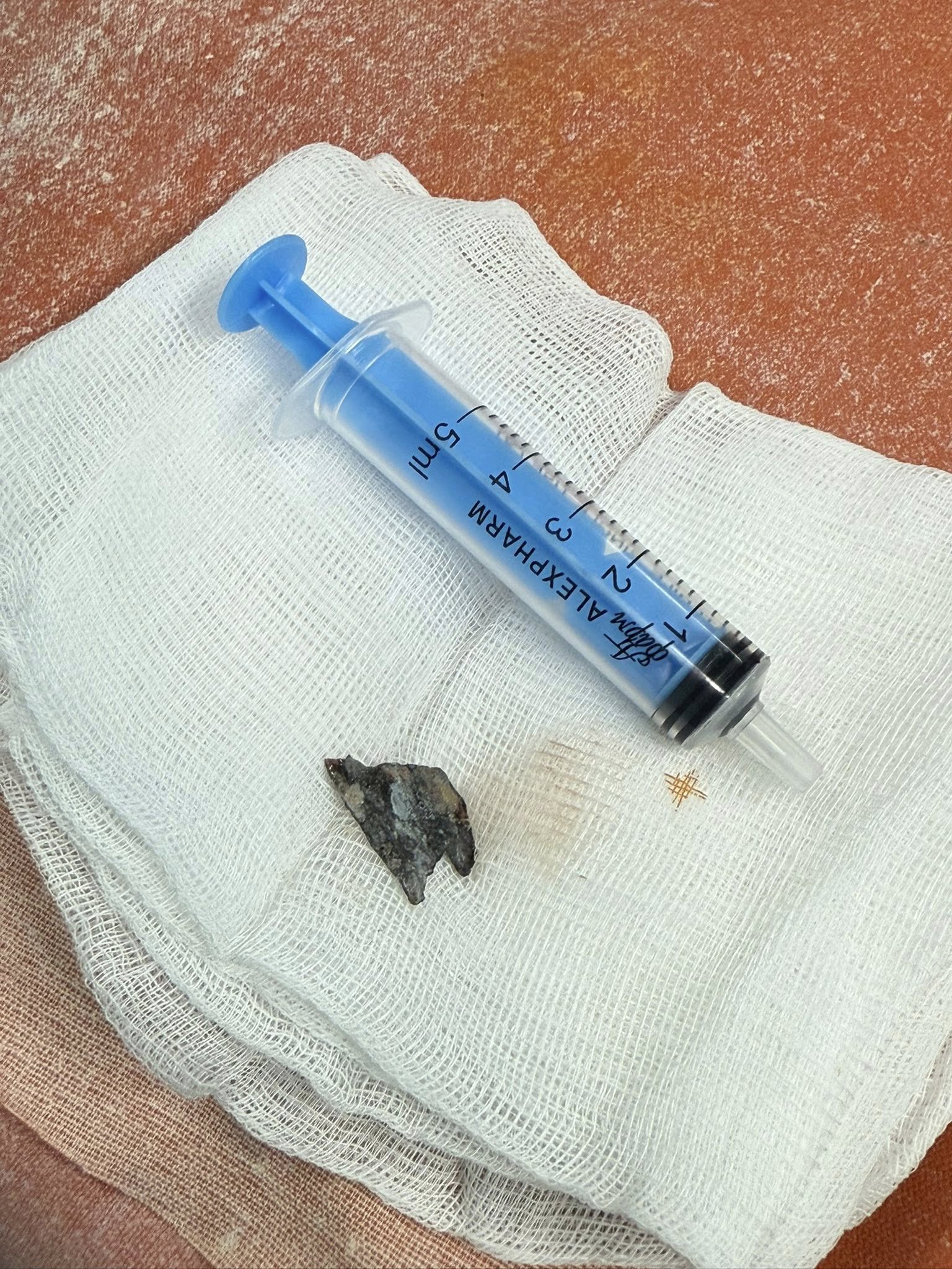 В Києві врятували життя 24-річному захиснику, який отримав важке поранення