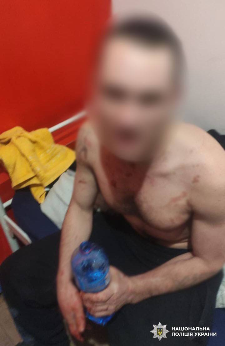 У Києві судитимуть зловмисника, який підірвав гранату в хостелі