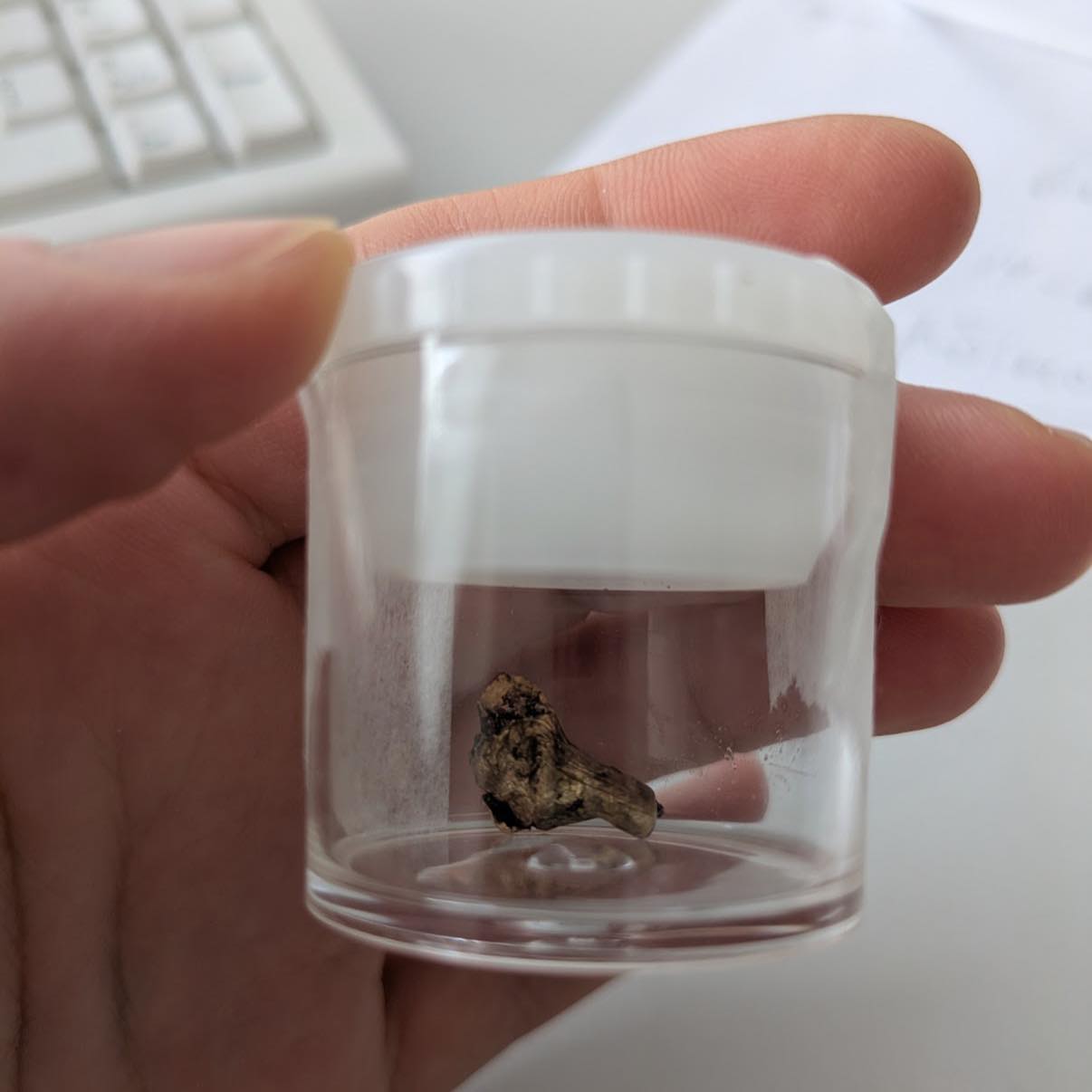 Унікальна операція в Києві: лікарі видалили кулю з орбіти ока - фото 2