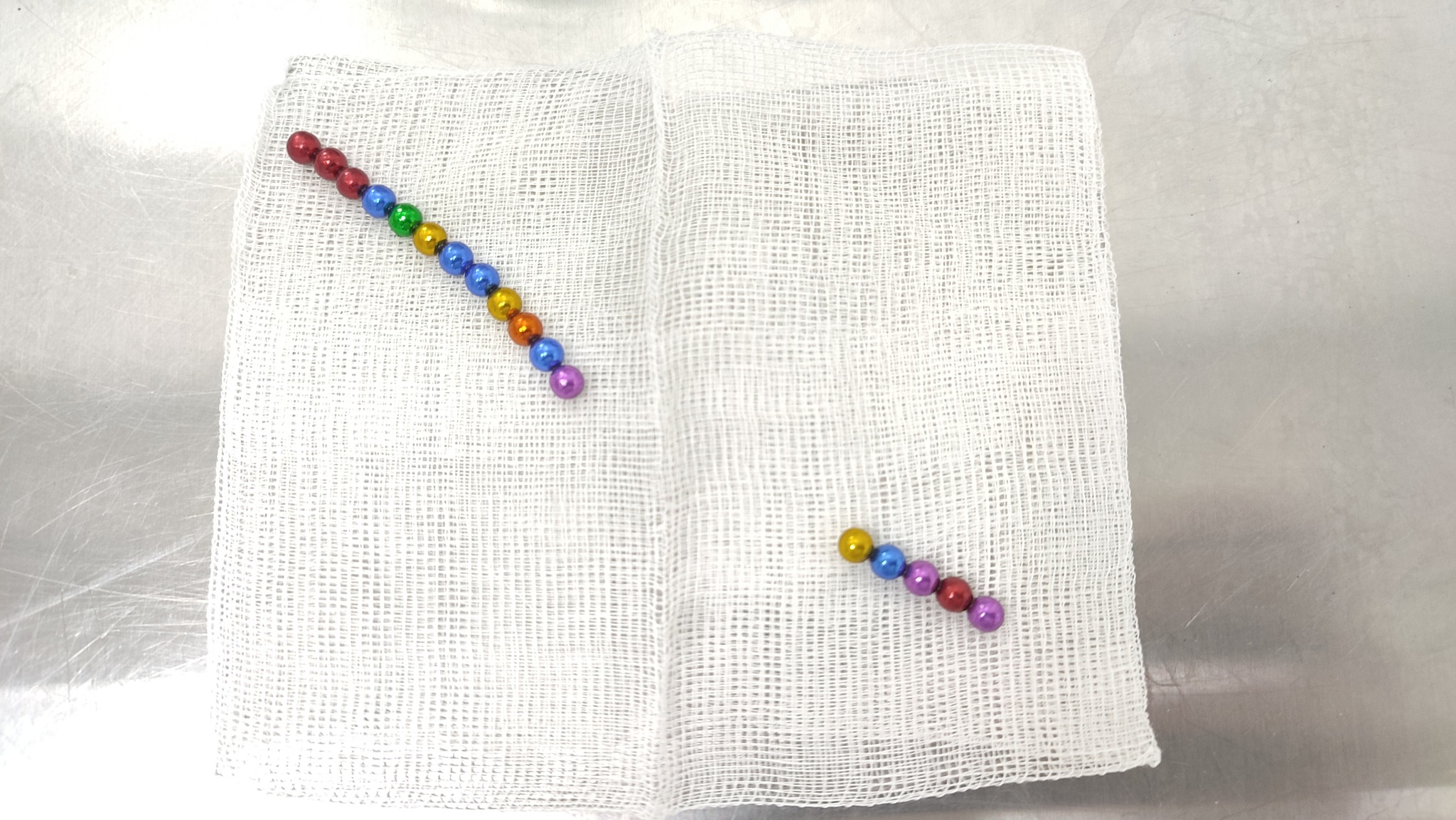 Київські медики дістали 17 магнітів із кишківника 5-річної дитини - фото 3